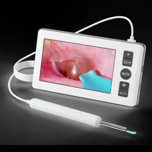Visual Ear Wax Removal Tool with HD Camera Screen